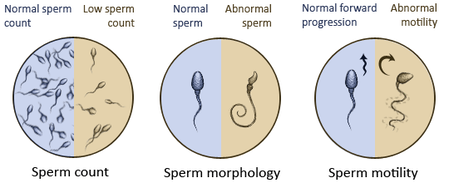 Ayurvedic treatment for Sperm issues